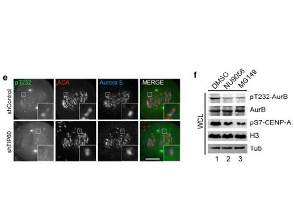 Immunofluorescence using Aurora B pT232